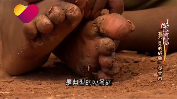 揭秘沙漠之虫神秘面纱，最新沙蚤视频揭晓真相